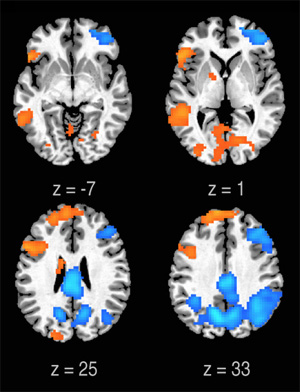 Freestyle fMRI