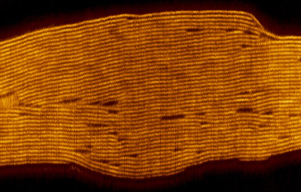 Nano Porous Membranes