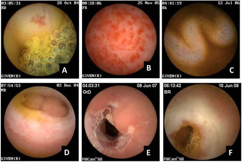 Journey to the Centre of the Gut